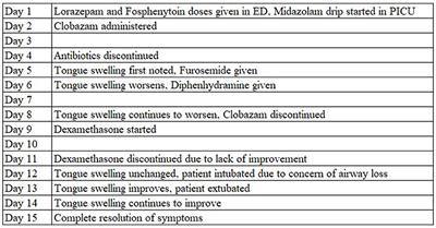 Macroglossia Associated With Clobazam Administration: A Case Report and Literature Review